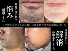 ジェントルメンズグロー(Gentlemen’s Glow)