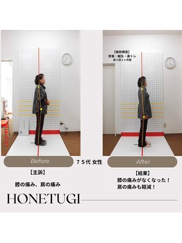 ほねつぎ総社 はりきゅう接骨院/成果/膝の痛み