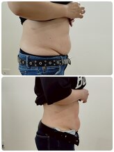 縁(en)/体重は増えても脂肪は減ってる！