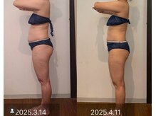 内側から健康的に綺麗に痩せる！世界中で認められた痩身コース