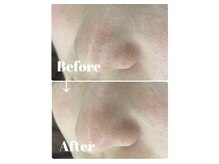 カラーリリー アンド ユン(Calla lily & yun)/