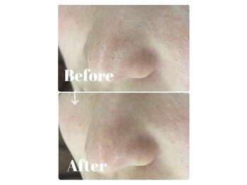 カラーリリー アンド ユン(Calla lily & yun)/