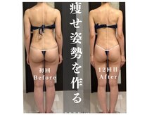 華奢な体型を造るには【骨格を整える】が必須★痩せやすい体質へ