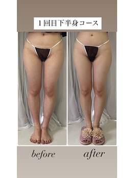 オパール(Opal)/下半身コース1回目(前)