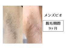 メンズビオ 神戸三宮店/