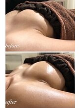 エスビューティー 三軒茶屋(S beauty)/バストケア・世田谷・痩身