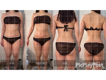 フィエルテ 甲斐敷島(FIERTE)/お客様 Before After