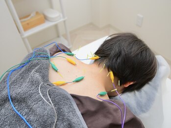 ココ(Coco)/鍼灸の施術