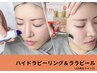 Jrスタッフ☆【韓国ツヤ肌】ハイドラピーリング(毛穴洗浄)＋ララピール/LED付