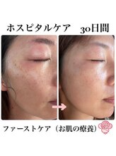 ケンビラク(Kenbiraku 健美楽)/ホスピタルファーストケアセット