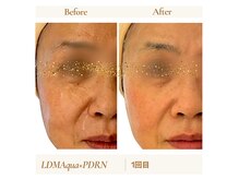 リサプリ(Re: Supple)の雰囲気（「LDMA」肌のしぼみ・毛穴・たるみケア◎肌の衰えを目覚めさせる）