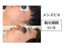 メンズビオ 神戸三宮店/