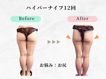 美容整体ウェリナ 中川八田院/小顔矯正/骨盤矯正/痩身整体