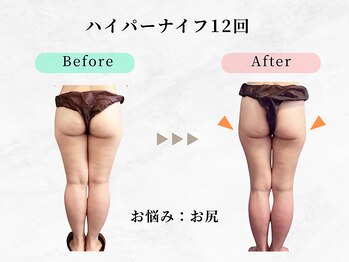 美容整体ウェリナ 中川八田院/小顔矯正/骨盤矯正/痩身整体