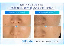 モモ(MOMO)の雰囲気(【セラピール】本気の毛穴、肌質改善◎ファンデーションいらず◎)