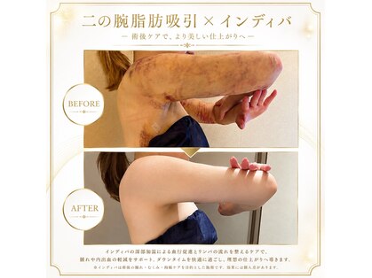 【DT短縮専門】インディバ＆ハイパーナイフ マドモアゼルMaison恵比寿　[9月NEWOPEN]の写真