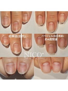 ニコプラス(NICO+)/自爪育成パラジェルクリア補強