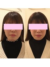 ユズ(yuzu)/◆顔の歪が気になる