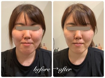 グレイスボディ ヨークタウン坂東店(Grace Body)/小顔フェイシャル