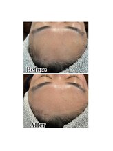 ケースタイル(k.style)/フェイシャルWAX