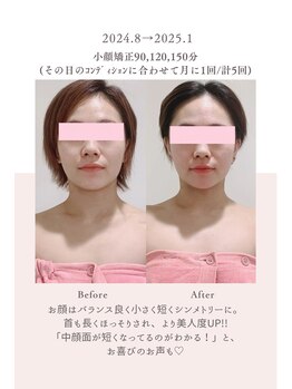 トゥインクル 麻布(twinkle)/白金高輪/シンメトリー小顔矯正