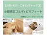 【毛穴/ニキビケア/むくみ】小顔コルギ＋ビオフィート　¥14000
