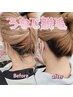 ＼＼復活キャンペーン２／／季節にぴったり◎後ろ髪美人【うなじ脱毛】