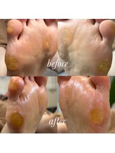 リゼラアンドコー 柏原店/痛いタコ！