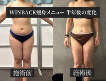 ソレイユ ベル(Soleil Belle)