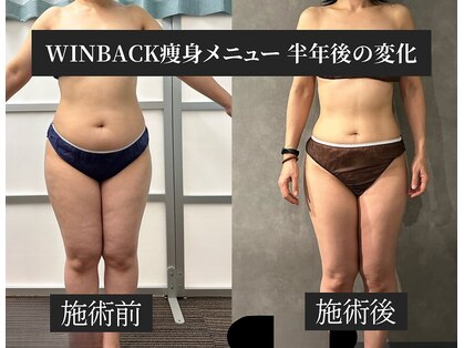 ソレイユ ベル(Soleil Belle)の写真