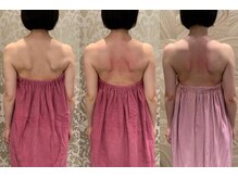 ロココ 豊田店(Rococo)/ビフォーアフター