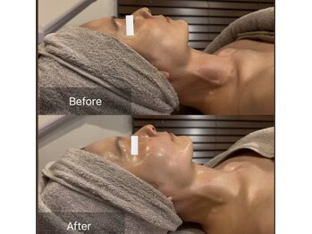 クレシア(CRECIA)/ララピール＋コルギ