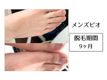 メンズビオ 神戸三宮店/