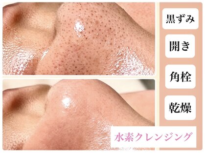 エムイーボーテ(me.Beaute)の写真