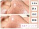 エムイーボーテ(me.Beaute)の写真