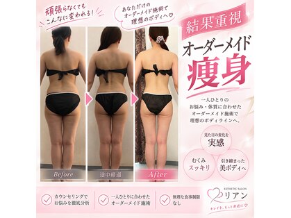 リアン(lien)の写真
