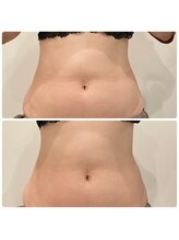 ルナート(Lunart)/おへその形に注目！腸もみ