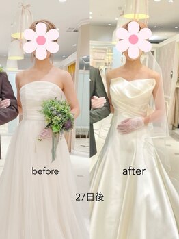 中目黒下半身ダイエット専門整体サロン/ビフォー アフター ブライダル
