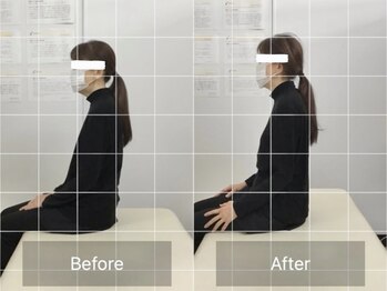 ナオル整体 国分寺院(NAORU整体)/50代女性【姿勢不良・肩の痛み】