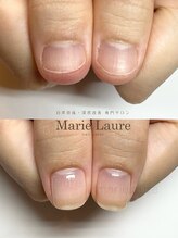 マリーロール 梅田店(Marie Laure)/自爪育成/深爪矯正/ネイルケア