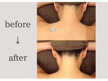 アネーロ(anhelo)/うなじ脱毛！