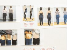 浜田接骨院 郡山院/ビフォーアフター写真