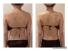 ボーテ(beaute)/【ビフォーアフター】