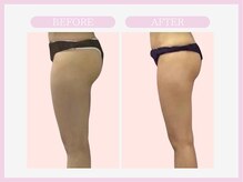 スリムライン 八戸店(The Slim Line)/before→after