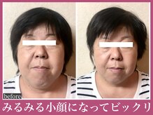 アクアビー(AQUA-B)/