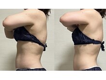 ヨルエステ(yoru aesthe)/【首、肩こり】