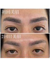 ミスキー 荻窪西口店(misky)/ワックス脱毛で肌もつるつやに