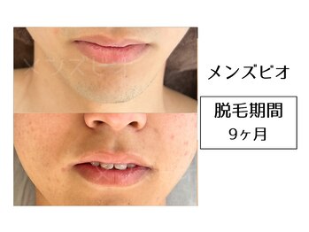 メンズビオ 神戸三宮店/