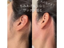 ハナサクラ 心斎橋(HANASAKURA)の雰囲気(うなじ+もみあげワックス脱毛♪横顔の印象が変わる)