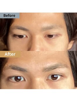 眉毛ハウス 吉祥寺店(眉毛HOUSE)/お客様の施術例(吉祥寺/東京)